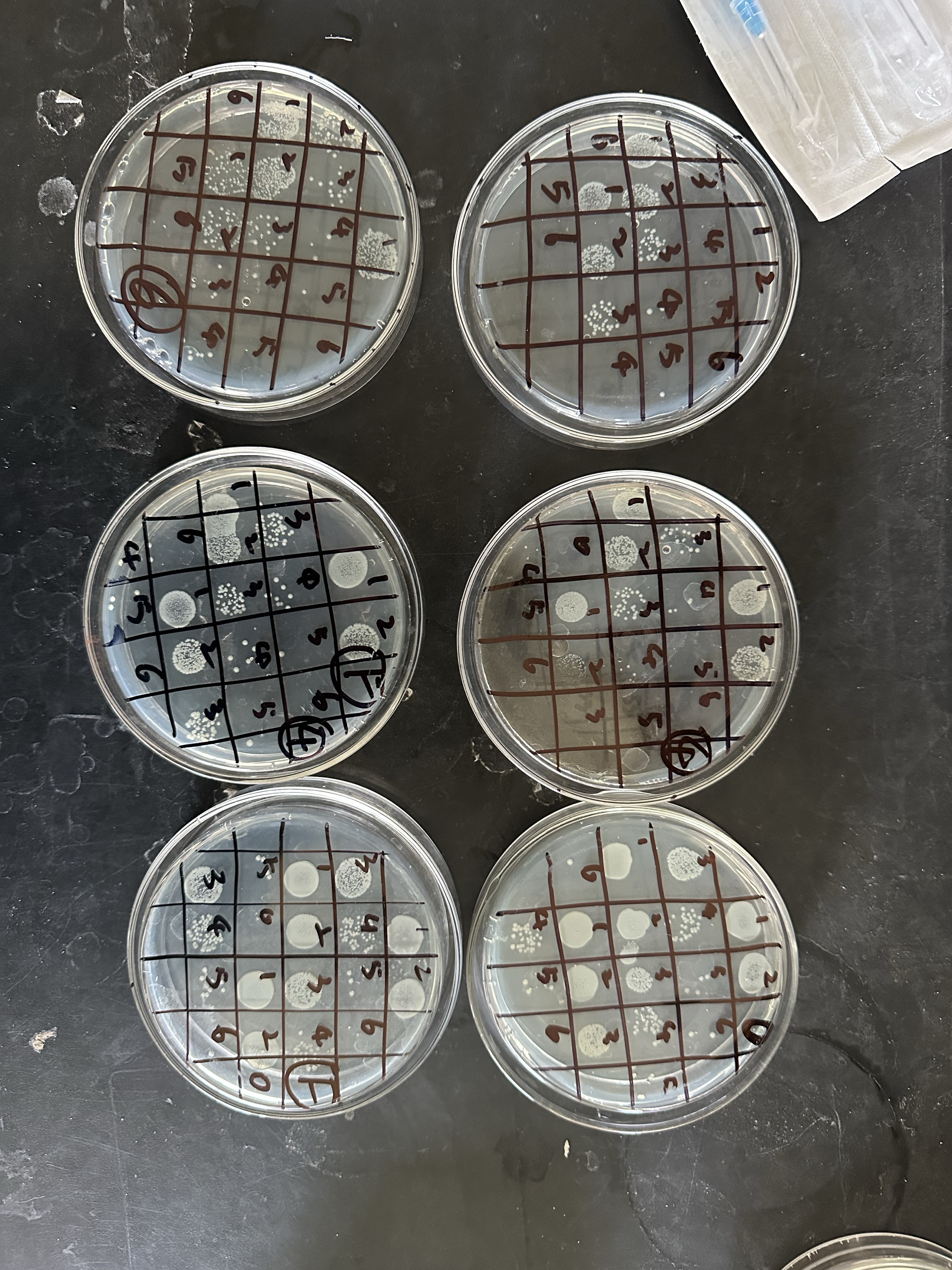 Agar plates from my undergraduate research